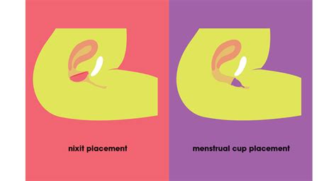 why is my period disc leaking|Menstrual Disc: Your A to Z Beginner Guide